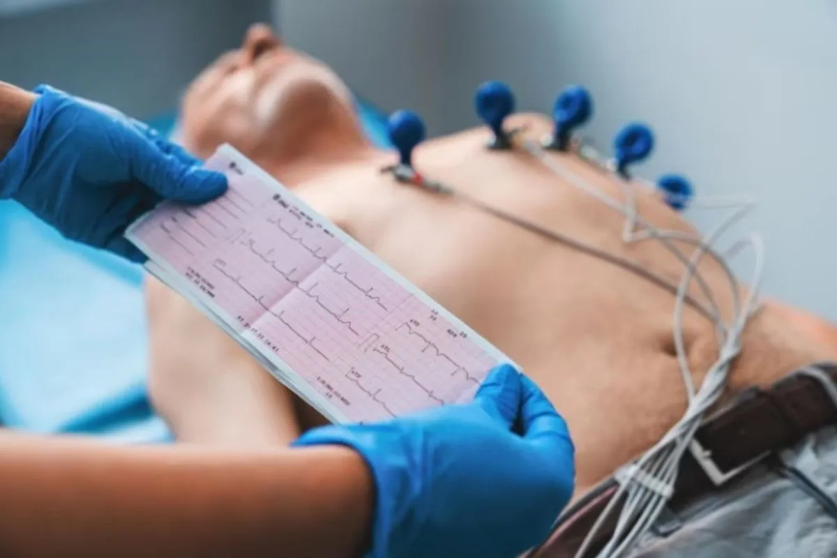 Electrocardiograma a domicilio